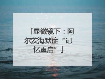 显微镜下：阿尔茨海默症“记忆重启”